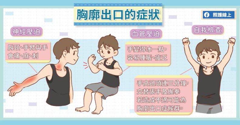 胸廓出口的症狀。