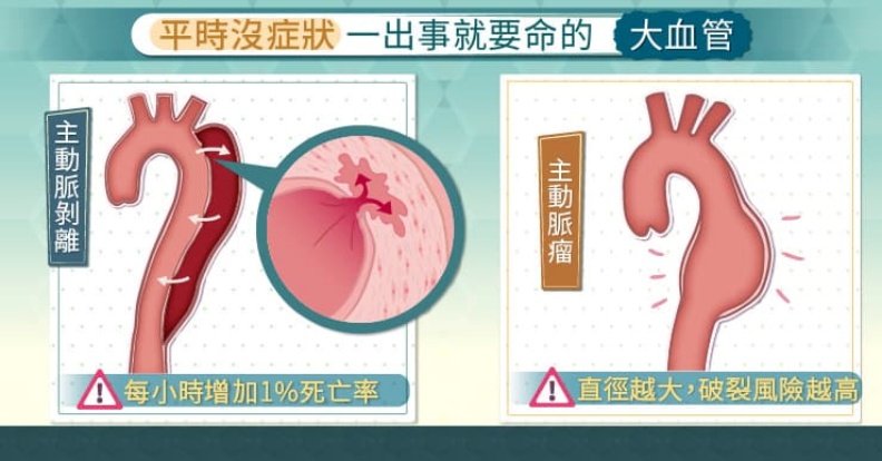 平時沒症狀,一出事就要命的大血管。取自照護線上