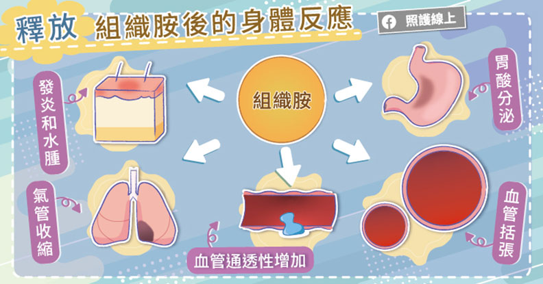 釋放組織胺後的身體反應。取自照護線上