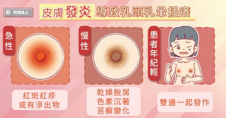 皮膚發炎,導致乳頭乳暈搔癢。取自照護線上