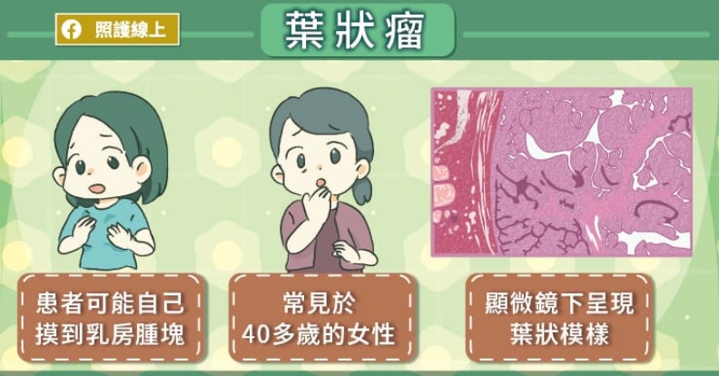葉狀瘤。取自照護線上