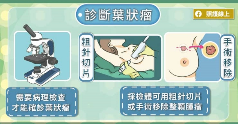 診斷葉狀瘤。取自照護線上