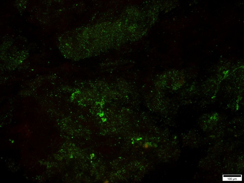 獸醫學系林昭男教授後送檢體至國家實驗室確診之頸椎壓片,螢光訊號為狂犬病抗原。