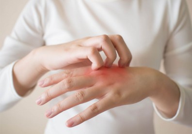 汗皰疹、異位性皮膚炎都是「濕疹」一員！３招對症改善告別水泡、皮膚癢
