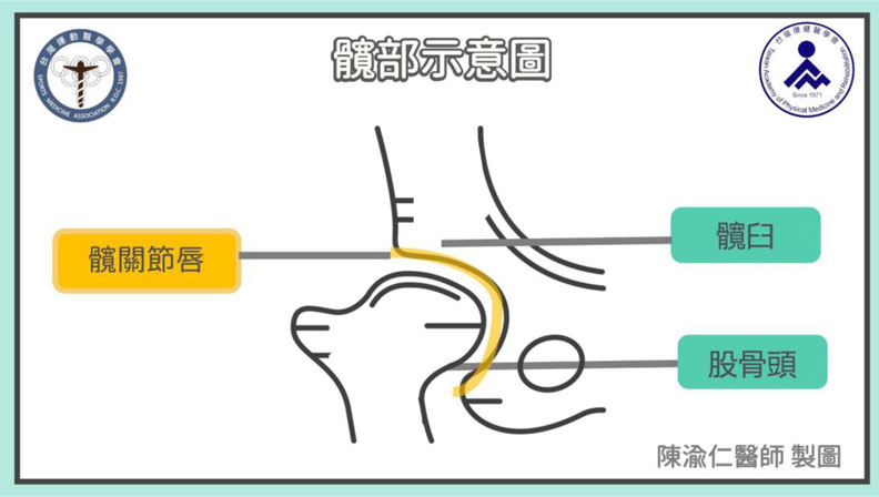 髖部示意圖。台灣運動醫學學會提供