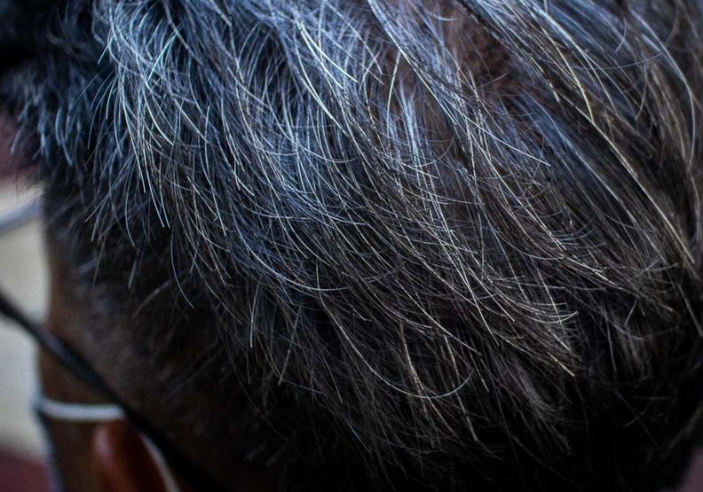 許多人因為工作壓力大,而導致整頭白髮。ricemedia