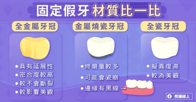 固定假牙材質比一比。取自照護線上
