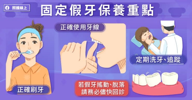 固定假牙保養重點。取自照護線上