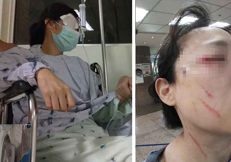 圖／左為挖眼案受害的超商女店員（莊全成提供）、右為北市挖眼案翻版受害者照片（取自爆料公社）。