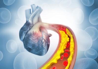 「好膽固醇」HDL愈高愈好？罹患心血管疾病風險愈低？最新研究解答