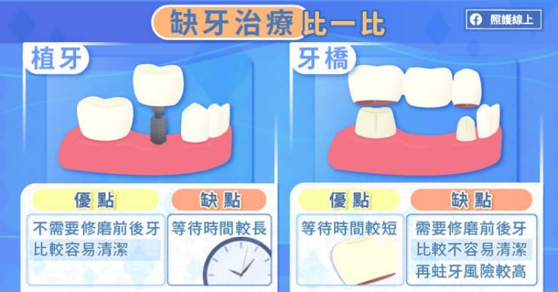 缺牙治療比一比。照護線上提供
