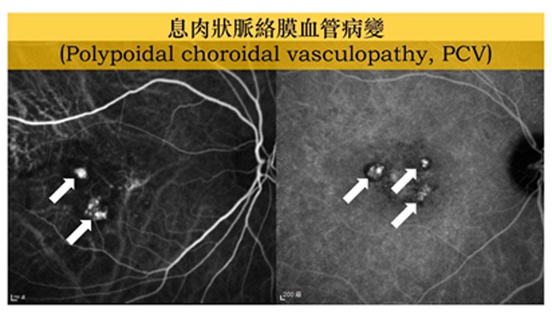亞東紀念醫院提供