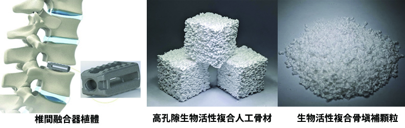 陳炳宜教授和生醫暨醫材博士班師生團隊研發的植入式醫材——椎間融合器植體、高孔隙生物活性複合人工骨材與生物活性複合骨填補顆粒之產品示意圖。(明志科大提供)
