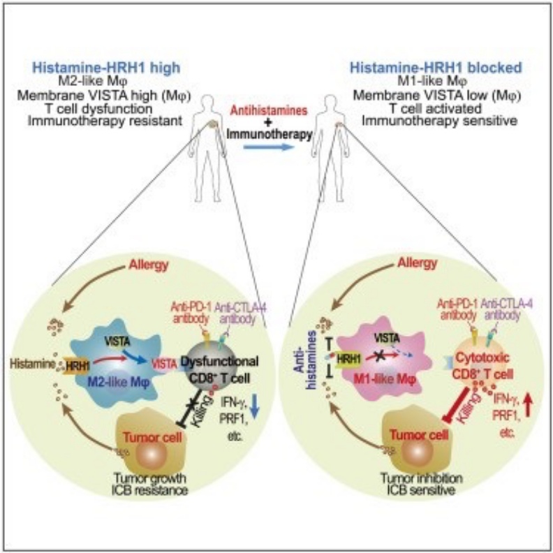 左邊的圓形中顯示,不論是過敏或是癌細胞本身分泌出來的組織胺,都會作用在巨噬細胞的HRH1受體上,接著增加VISTA的表達,然後影響T細胞,最後造成無法殺死癌細胞(黑色Killing上面出現叉叉)。右邊的圓形裡面,給了一顆抗組織胺藥,阻斷HRH1後續表達VISTA的情況,因此,維持了T細胞的殺敵功能(紅色Killing)。 潘懷宗教授提供