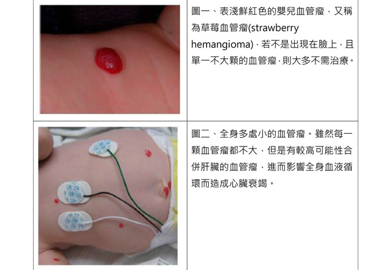 台北市立聯合醫院提供