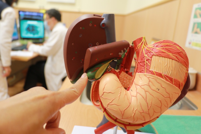 膽囊功能是儲存濃縮肝臟製造多餘的膽汁。台中慈濟醫院提供