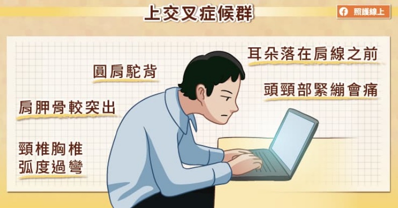 上交叉症候群的症狀。照護線上提供