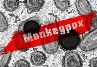 醫貼猴痘病例報告！不只皮疹恐釀肛門及陰莖潰瘍，排便、睡覺都有問題