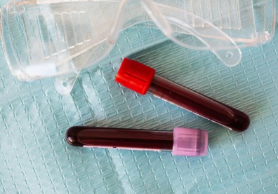 新冠病毒為何會引發腦霧等「長新冠」症狀？專家發現血液出現３大特徵
