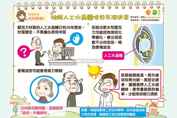 人工水晶體能撐多久？使用年限問題大解密！