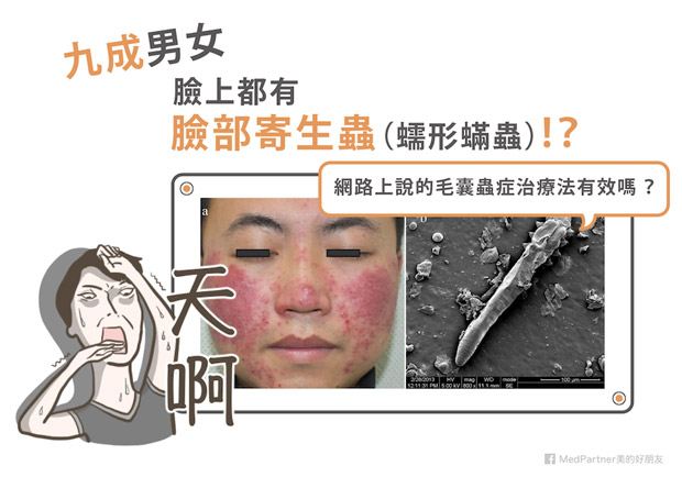 九成男女都有臉部寄生蟲？網路上查的毛囊蟲症治療法有效嗎？