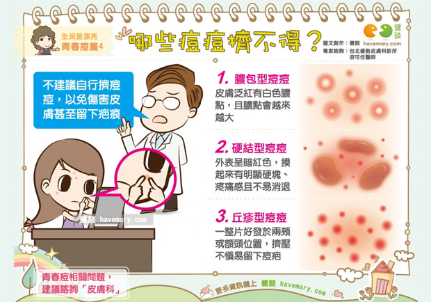 哪些痘痘擠不得？
