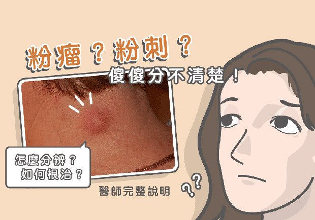 粉瘤如何根治？粉瘤跟粉刺怎麼分辨？醫師完整說明