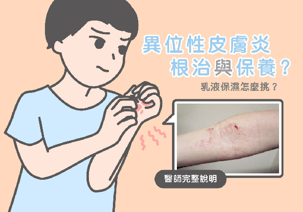 異位性皮膚炎根治與保養教學！醫師完整說明