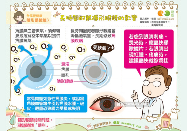 長時間配戴隱形眼鏡的影響
