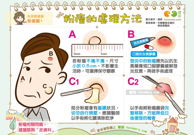常見皮膚問題：粉瘤的處理方法