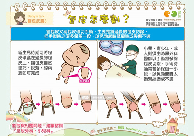 包皮怎麼割？