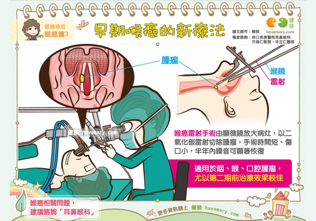 早期喉癌的新療法