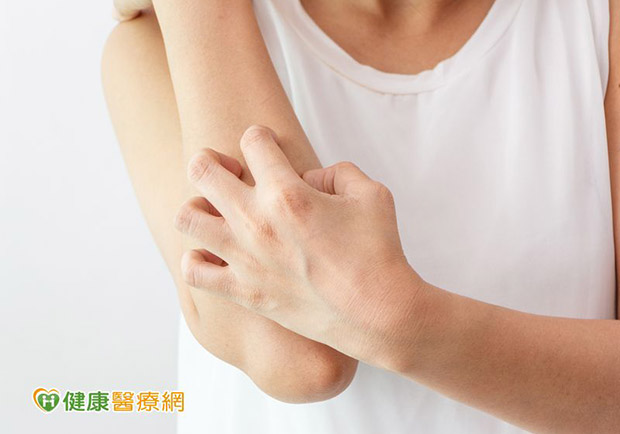 蚊咬搔癢難耐？這些方法可有效止癢