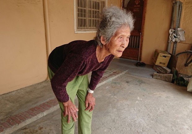 嘉義阿嬤後仰摔倒，駝背居然挺直了！醫：難以解釋