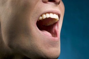 防治口腔癌，黏膜潰瘍二週速就醫