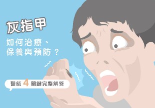 灰指甲如何治療、保養與預防？醫師 4 關鍵完整解答