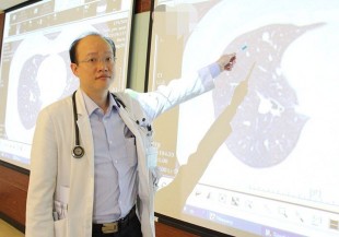 35 歲女脖子微腫不會痛，健檢查出癌末