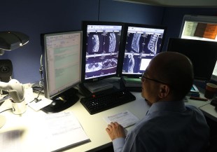 貧血、尿泡、下背痛…當心是多發性骨隨瘤
