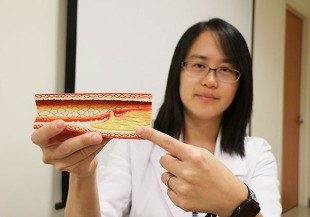 胸痛別大意！心血管疾病年輕化，小心心肌梗塞悄上身