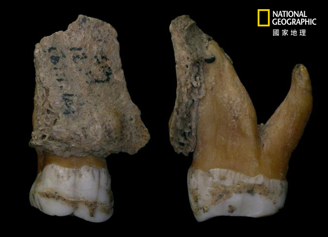 誰是尼安德塔人的牙醫？_img_2