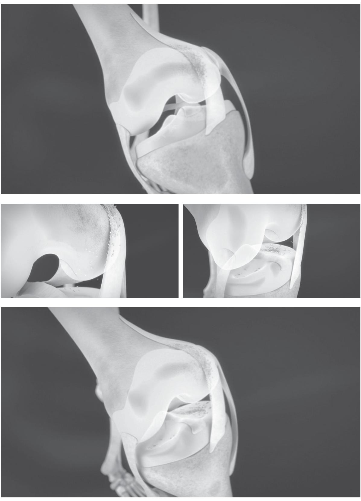 「退化」性膝關節炎,不是「退化」引起的?_img_2