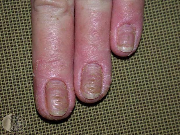 保濕觀念錯誤陷阱你也中了嗎?醫師圖文教你保濕關鍵_img_10