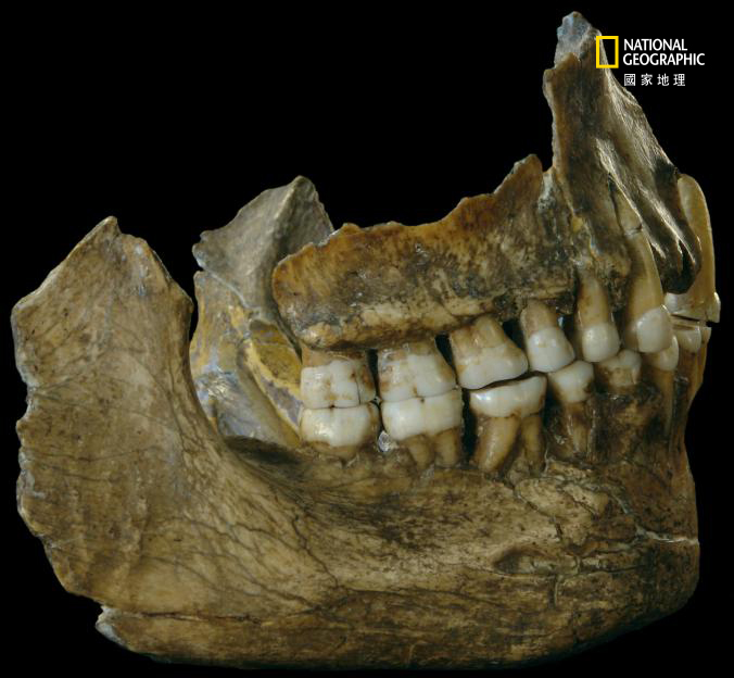誰是尼安德塔人的牙醫？_img_1