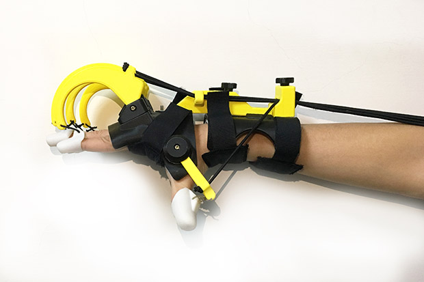 職能治療之副木製作與3D列印之應用_img_1