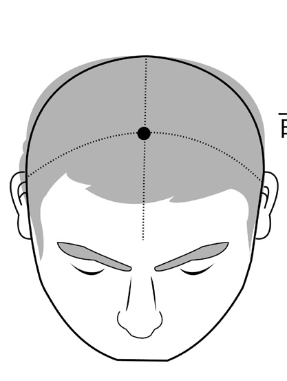 奇蹟清淡飲食法,10 年偏頭痛不藥而癒_img_1