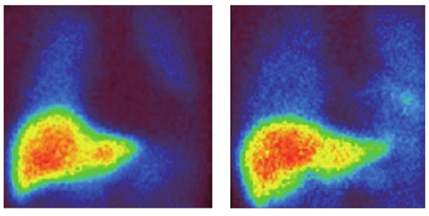 為什麼失智症病人晚上不睡覺?_img_1